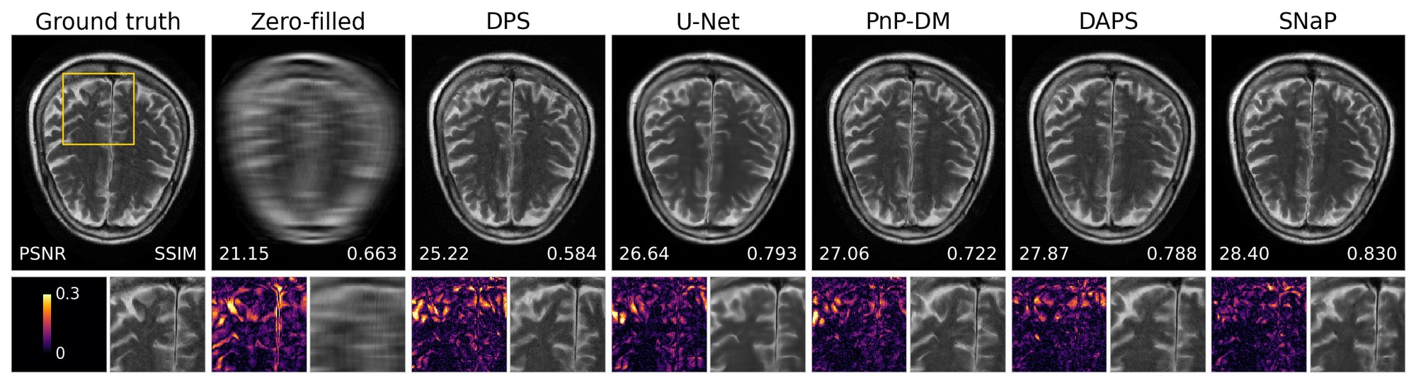 Multi-coil fastMRI brain reconstructions at 8x acceleration and 20 dB input SNR